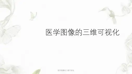 医学图像的三维可视化PPT课件