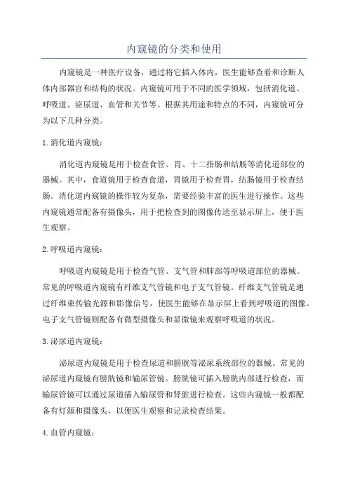 内窥镜的分类和使用