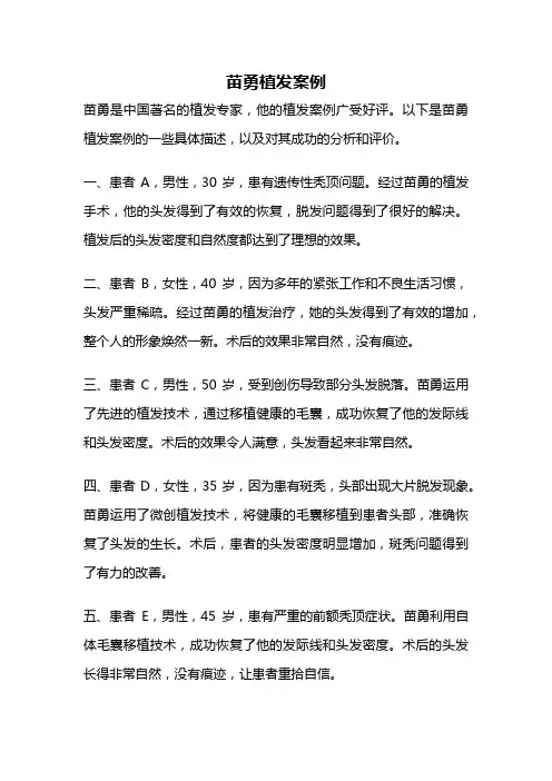 苗勇植发案例