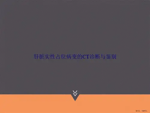 肝脏实性占位病变的CT诊断与鉴别讲课文档