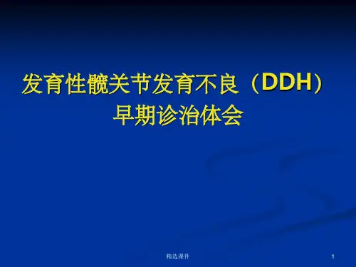 发育性髋关节发育不良早期诊断治疗pptppt课件