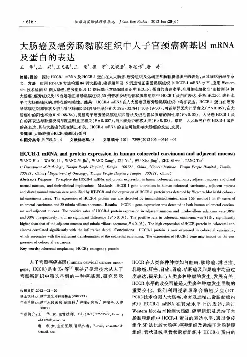 大肠癌及癌旁肠黏膜组织中人子宫颈癌癌基因mRNA及蛋白的表达