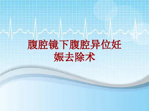 手术讲解模板：腹腔镜下腹腔异位妊娠去除术