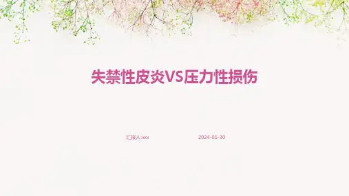 失禁性皮炎VS压力性损伤PPT课件