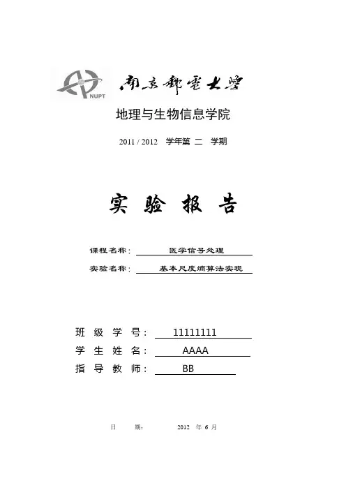 MATLAB实现基本尺度熵算法