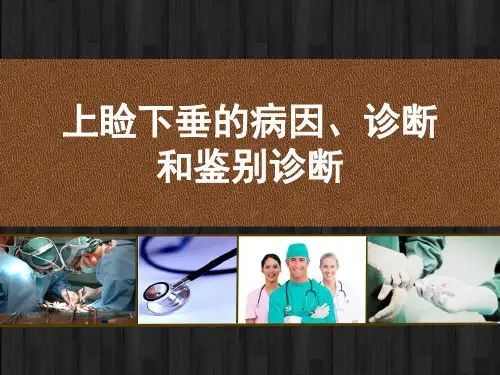 上睑下垂的病因、诊断和鉴别诊断 PPT
