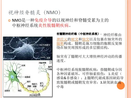 nmo