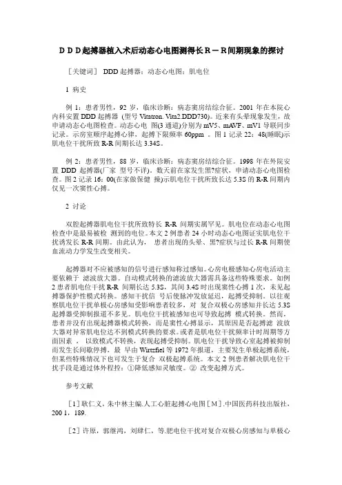 DDD起搏器植入术后动态心电图测得长R-R间期现象的探讨