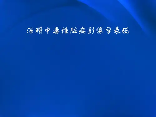酒精中毒性脑病影像学表现PPT