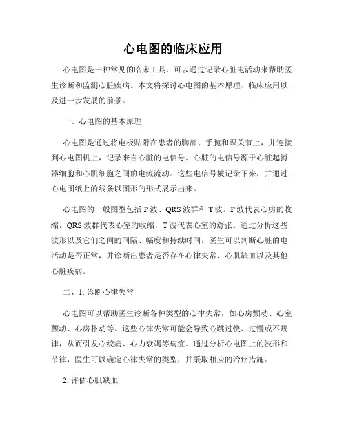 心电图的临床应用