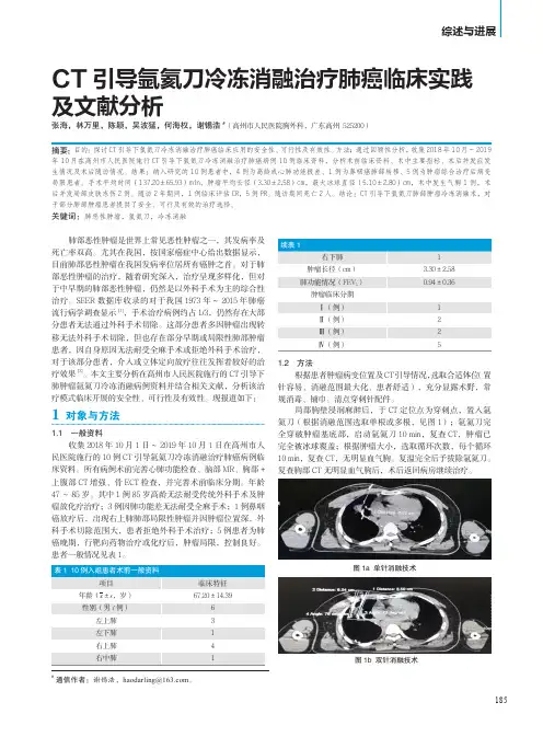 CT引导氩氦刀冷冻消融治疗肺癌临床实践及文献分析