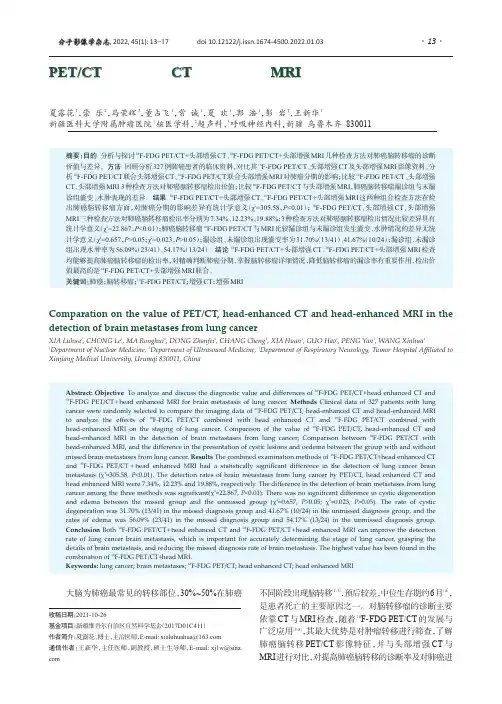 PETCT、头部增强CT和头部增强MRI对肺癌脑转移瘤检出价值的对比