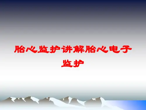 胎心监护讲解胎心电子监护培训课件