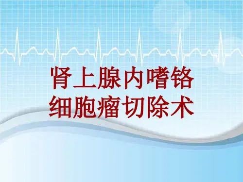 手术讲解模板：肾上腺内嗜铬细胞瘤切除术