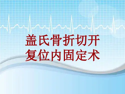 手术讲解模板：盖氏骨折切开复位内固定术