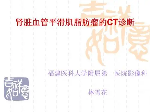 肾脏血管平滑肌脂肪瘤的ct诊断ppt课件