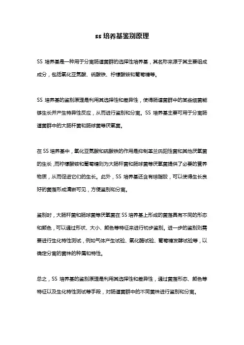 ss培养基鉴别原理