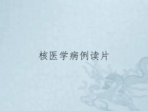核医学病例读片