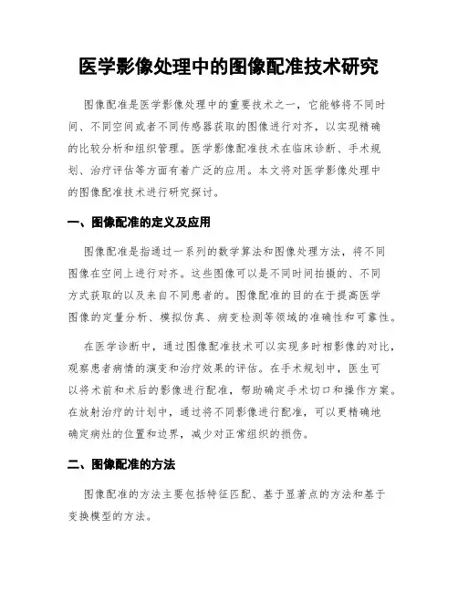 医学影像处理中的图像配准技术研究