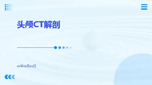 (医学课件)头颅CT解剖