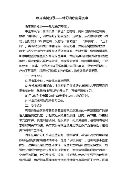 临床病例分享——针刀治疗肩周炎中...