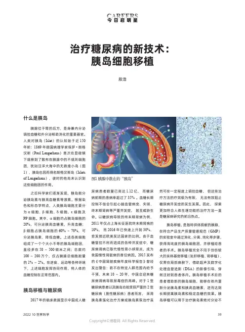 治疗糖尿病的新技术：胰岛细胞移植