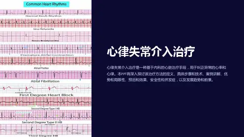 心律失常介入治疗PPT