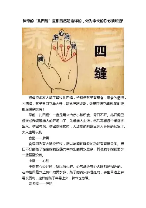 神奇的“扎四缝”真相竟然是这样的，做为家长的你必须知道!
