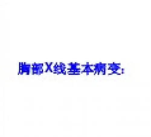 胸部X线