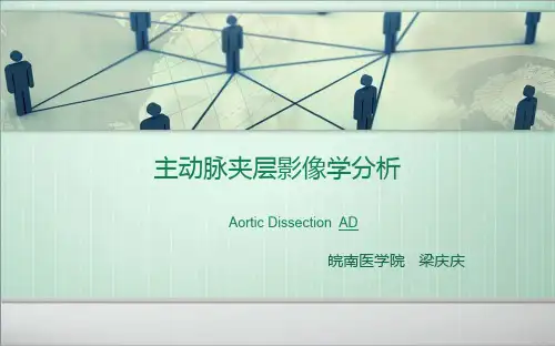 主动脉夹层影像学分析PPT课件