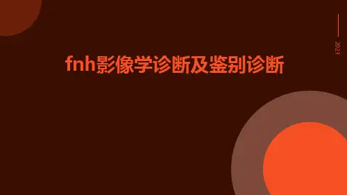 FNH影像学诊断及鉴别诊断