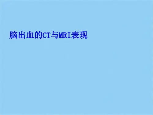脑出血的影像学表现(共9张PPT)
