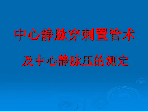 中心静脉穿刺置管术