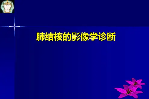 肺结核的影像学诊断