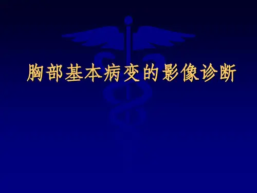 胸部基本病变的影像诊断