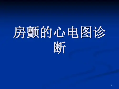 房颤的心电图诊断ppt课件