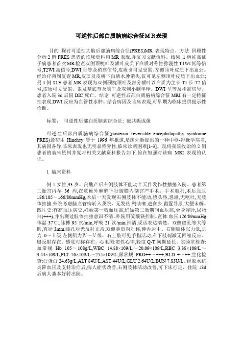 可逆性后部白质脑病综合征MR表现