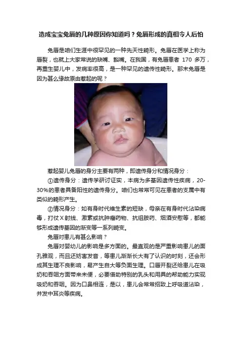 造成宝宝兔唇的几种原因你知道吗？兔唇形成的真相令人后怕