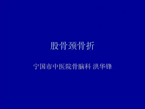 股骨颈骨折