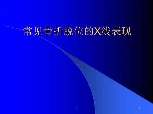 常见骨折脱位X线表现课件PPT课件精选全文