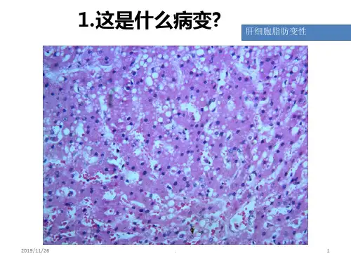 病理切片考试复习PPT课件
