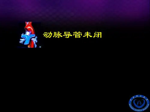动脉导管未闭超声诊断PPT课件