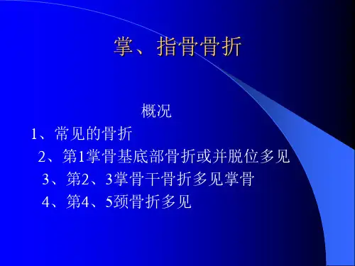 掌指骨骨折ppt课件