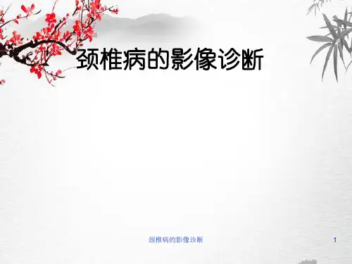 颈椎病的影像诊断【78页】