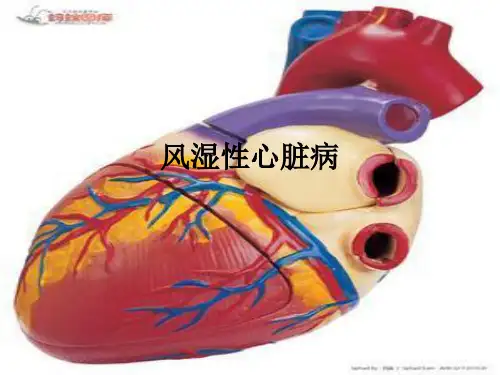 风湿性心脏病ppt课件 (2)