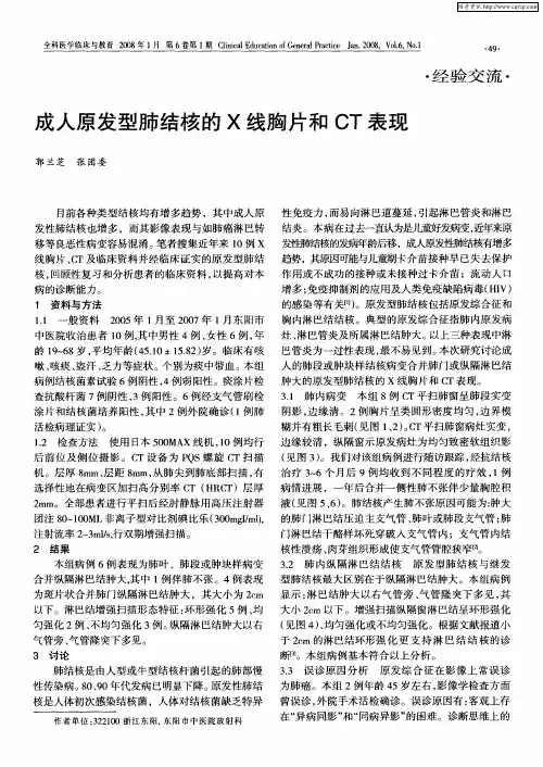 成人原发型肺结核的X线胸片和CT表现