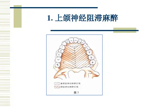 上颌神经阻滞麻醉