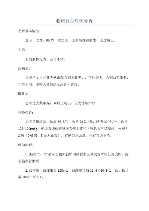 临床典型病例分析