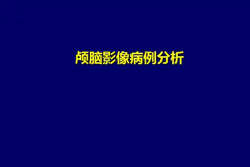 颅脑常见病变的CT诊断