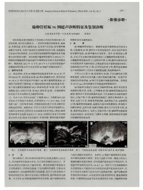 输卵管妊娠96例超声诊断特征及鉴别诊断